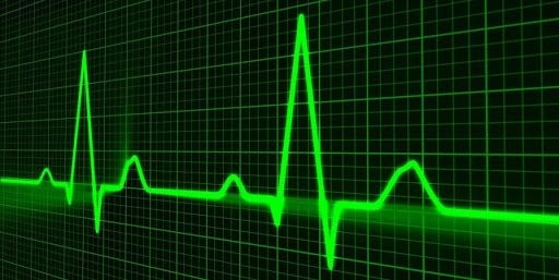 نوار قلب چیست و نوار قلب طبیعی چگونه است؟