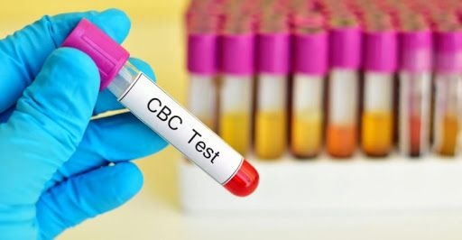 تفسیر جواب آزمایش خون CBC