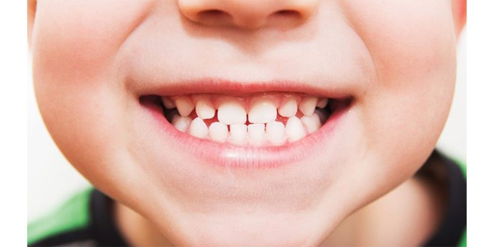 چرا رسیدگی به دندان شیری مهم است؟